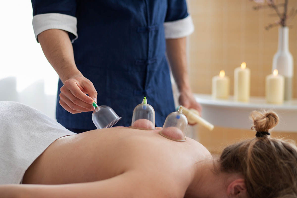 Cupping and Dry Needling